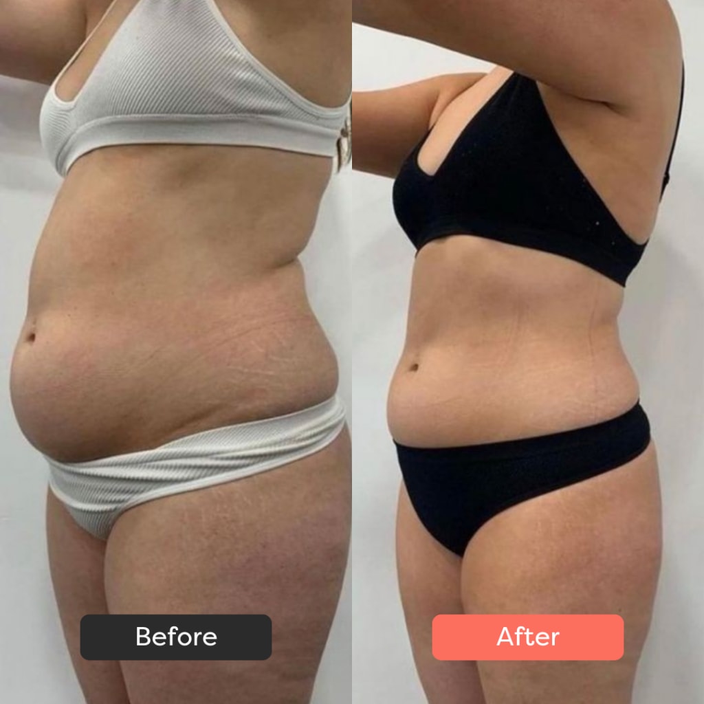 Evelano ThermoSlim Pro EVELANO