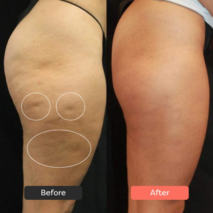 Evelano ThermoSlim Pro EVELANO